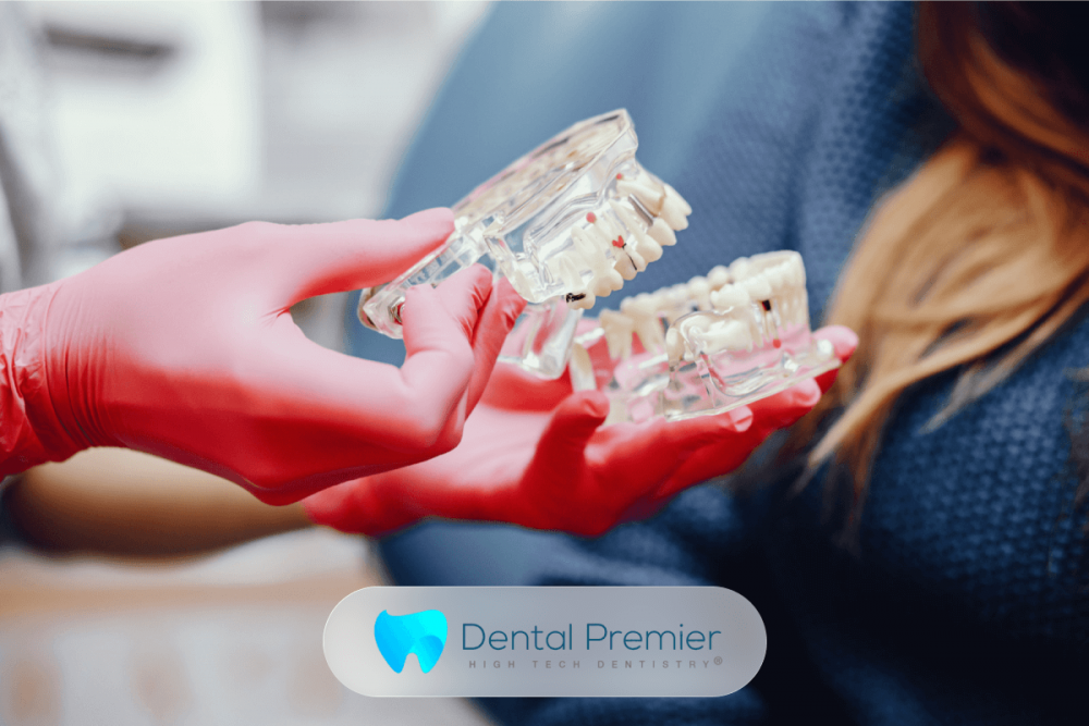 Implantul dentar Straumann: unde poate fi realizat în România? Totul aici despre clinica Dental Premier